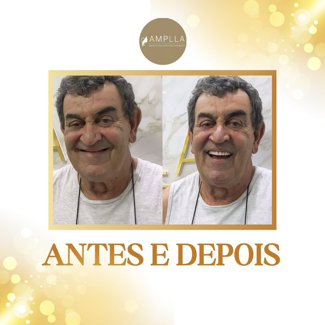 Antes e depois — caso 1 · Amplla Odontologia